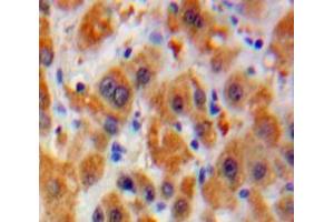 Used in DAB staining on fromalin fixed paraffin-embedded Liver tissue (Laminin alpha 5 anticorps  (AA 3517-3718))