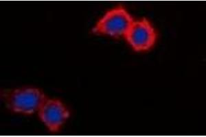 Immunofluorescent analysis of NHE8 staining in HepG2 cells. (NHE8 anticorps  (C-Term))