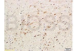 Formalin-fixed and paraffin embedded rat brain labeled with Anti-ChAT Polyclonal Antibody, Unconjugated (ABIN724070) 1:200followed by conjugation to the secondary antibody and DAB staining (Choline Acetyltransferase anticorps  (AA 101-200))