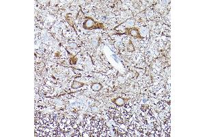 Immunohistochemistry of paraffin-embedded mouse brain using Neurofilament L Rabbit mAb (ABIN7268867) at dilution of 1:100 (40x lens). (NEFL anticorps)
