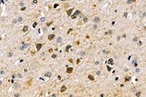 Immunohistochemistry analysis of paraffin-embedded mouse brain using,SLC6A15 (ABIN7075681) at dilution of 1: 600