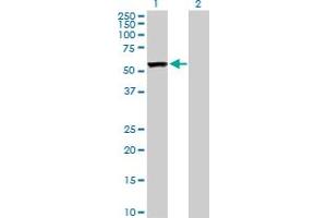 Western Blot analysis of CAP1 expression in transfected 293T cell line by CAP1 MaxPab polyclonal antibody. (CAP1 anticorps  (AA 1-475))