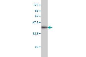 Western Blot detection against Immunogen (37.