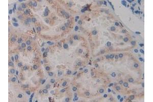 Detection of ABP1 in Human Kidney Tissue using Polyclonal Antibody to Amiloride Binding Protein 1 (ABP1)