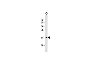 Anti-KLK7-S82 at 1:2000 dilution + TT whole cell lysate Lysates/proteins at 20 μg per lane.