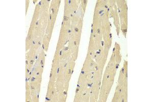 Immunohistochemistry of paraffin-embedded mouse heart using USP7 antibody at dilution of 1:200 (400x lens). (USP7 anticorps)