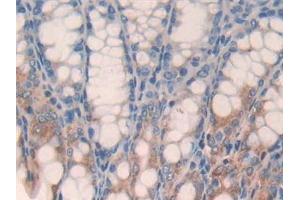 Detection of GPC3 in Mouse Small intestine Tissue using Polyclonal Antibody to Glypican 3 (GPC3) (Glypican 3 anticorps  (AA 344-559))