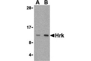 Western Blotting (WB) image for anti-Harakiri, BCL2 Interacting Protein (Contains Only BH3 Domain) (HRK) (Middle Region) antibody (ABIN1030949) (HRK anticorps  (Middle Region))