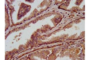 IHC image of ABIN7172879 diluted at 1:800 and staining in paraffin-embedded human prostate tissue performed on a Leica BondTM system.