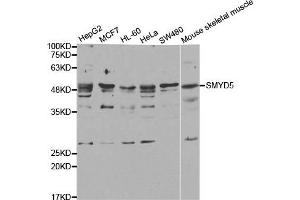 Western Blotting (WB) image for anti-SMYD Family Member 5 (SMYD5) antibody (ABIN1882323) (SMYD5 anticorps)