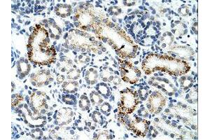 Image no. 1 for anti-Zinc Finger (CCCH Type), RNA-Binding Motif and serine/arginine Rich 2 (ZRSR2) (AA 369-418) antibody (ABIN202635)