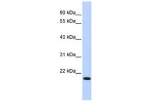 Image no. 1 for anti-Interferon Regulatory Factor 7 (IRF7) (AA 35-84) antibody (ABIN6742766)
