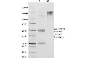 SDS-PAGE Analysis Purified MAGE-1 Mouse Monoclonal Antibody (MA454).