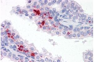 Anti-TM9SF1 antibody  ABIN960827 IHC staining of human prostate. (TM9SF1 anticorps  (N-Term))