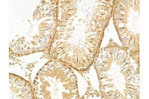 ABIN6260492 and ABIN6268884 at 1/100 staining Rat testis tissue by IHC-P. (CTNNA1 anticorps  (C-Term))