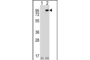 Western blot analysis of WHSC1L1 (arrow) using rabbit polyclonal WHSC1L1 Antibody (N-term) (ABIN656685 and ABIN2845923). (WHSC1L1 anticorps  (N-Term))