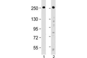 Western blot testing of human 1) HeLa and 2) SH-SY5Y cell lysate with ROBO1 antibody at 1:2000.
