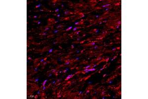 Immunofluorescence of paraffin embedded rat heart using SMYD2 (ABIN7075581) at dilution of 1:2000 (400x lens)