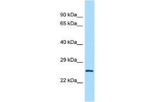 Host:  Rabbit  Target Name:  Lrrc14  Sample Type:  Mouse Testis lysates  Antibody Dilution:  1. (LRRC14 anticorps  (C-Term))