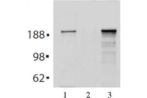Tes2 mAb (Clone 21F11) tested by Immunoprecipitation. (TET2 anticorps  (AA 1-300))