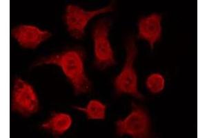 ABIN6266612 staining HeLa by IF/ICC. (p63 anticorps  (C-Term))