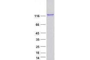 Validation with Western Blot