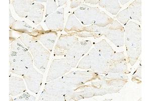 Phospho-TOP2A (Thr1343) Antibody at 1/100 staining Mouse muscle tissue by IHC-P. (Topoisomerase II alpha anticorps  (pThr1343))