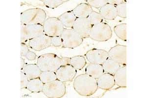 Immunohistochemistry of paraffin embedded mouse skeletal muscle using SIX1 (ABIN7075617) at dilution of 1: 650 (400x lens) (SIX Homeobox 1 anticorps)