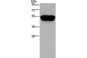 Western Blot analysis of Hela cell using CD160 Polyclonal Antibody at dilution of 1:250 (CD160 anticorps)