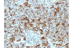 IHC testing of FFPE human pancreas with Spectrin beta III antibody (clone SPTBN2/1583). (Spectrin, Beta, Non-erythrocytic 2 (SPTBN2) (AA 356-475) anticorps)
