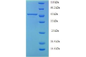 SDS-PAGE (SDS) image for Alanine Glyoxylate Aminotransferase (AGXT) (AA 1-392), (full length) protein (His tag) (ABIN5709013)