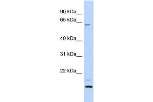 WB Suggested Anti-TCP11L2 Antibody Titration: 0. (TCP11L2 anticorps  (N-Term))