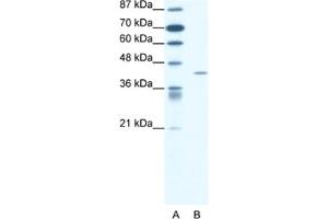 Western Blotting (WB) image for anti-Forkhead Box L2 (FOXL2) antibody (ABIN2460700)