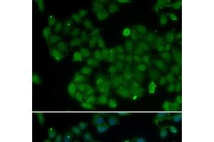 Immunofluorescence analysis of U2OS cells using DNMT3L Polyclonal Antibody (DNMT3L anticorps)