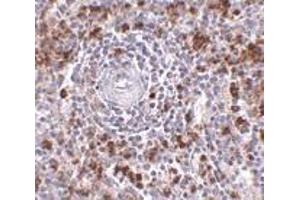 Immunohistochemistry of EBI3 in human spleen tissue with EBI3 antibody at 2.