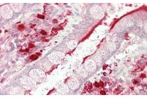 Detection of ACE in Human Small Intestine Tissue using Polyclonal Antibody to Angiotensin I Converting Enzyme (ACE)