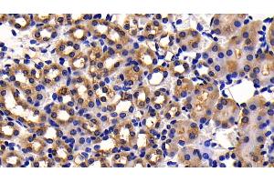 Detection of CD26 in Mouse Kidney Tissue using Polyclonal Antibody to Cluster Of Differentiation 26 (CD26)