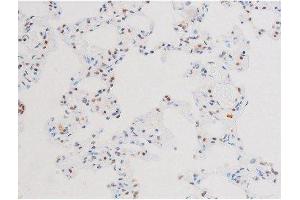ABIN6267602 at 1/200 staining Rat lung tissue sections by IHC-P. (NF-kB p65 anticorps  (pSer281))