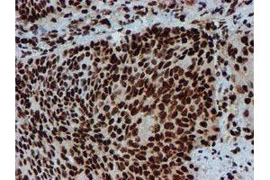 Image no. 11 for anti-Peptidyl Arginine Deiminase, Type IV (PADI4) antibody (ABIN1500017)