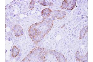 IHC-P Image FRS2 antibody detects FRS2 protein at membrane on HSC-3 xenograft by immunohistochemical analysis. (FRS2 anticorps  (Center))