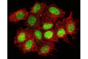 IF analysis of Nac1/NACC1 using anti-Nac1/NACC1 antibody (ABIN7599756).