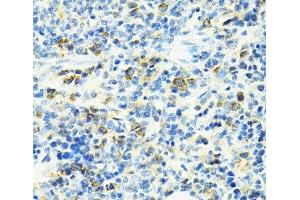 Immunohistochemistry of paraffin-embedded Rat spleen using SLC25A11 Polyclonal Antibody at dilution of 1:100 (40x lens). (SLC25A11 anticorps)