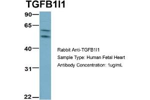 Host:  Rabbit  Target Name:  TGFB1I1  Sample Type:  Human Fetal Heart  Antibody Dilution:  1.