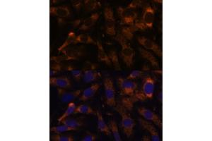Immunofluorescence analysis of U-2 OS cells using SUCLG2 Polyclonal Antibody  at dilution of 1:100 (40x lens).