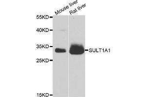 Western blot analysis of extracts of various cell lines, using SULT1A1 antibody. (SULT1A1 anticorps  (AA 1-295))