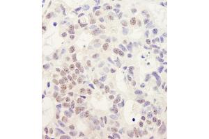 anti-DEAH (Asp-Glu-Ala-His) Box Polypeptide 38 (DHX38) (C-Term) antibody