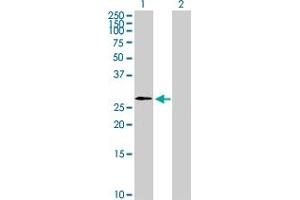 Western Blot analysis of WBP2NL expression in transfected 293T cell line by WBP2NL MaxPab polyclonal antibody. (WBP2NL anticorps  (AA 1-309))