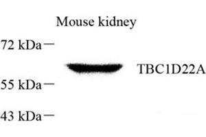 Western blot analysis of TBC1D22A (ABIN7075845) at dilution of 1: 800