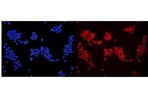 IF analysis of DDB1 using anti-DDB1 antibody (ABIN3043823). (DDB1 anticorps  (AA 1011-1140))