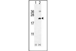 Western blot analysis of IL17F (arrow) using Interleukin-17F / IL17F Antibody (N-term) Cat. (IL17F anticorps  (N-Term))